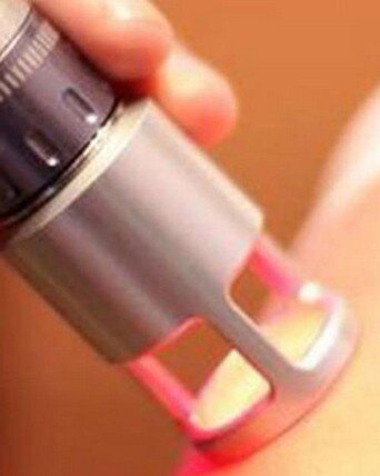 laser terapia laser terapia
